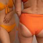 LPG Endermologie corporal: ¿cómo ayuda a reducir grasa y celulitis?